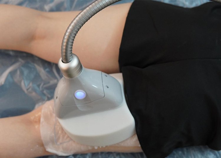 Coolsculpting Machine Therapy